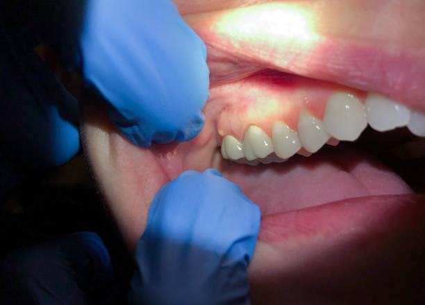 Best Emergency Denture Repair in Socorro, TX